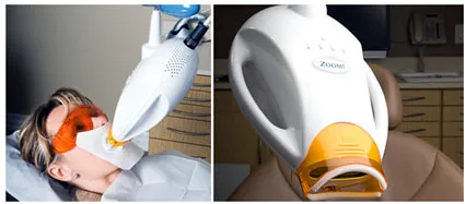 31461 zoom teeth whitening consultation