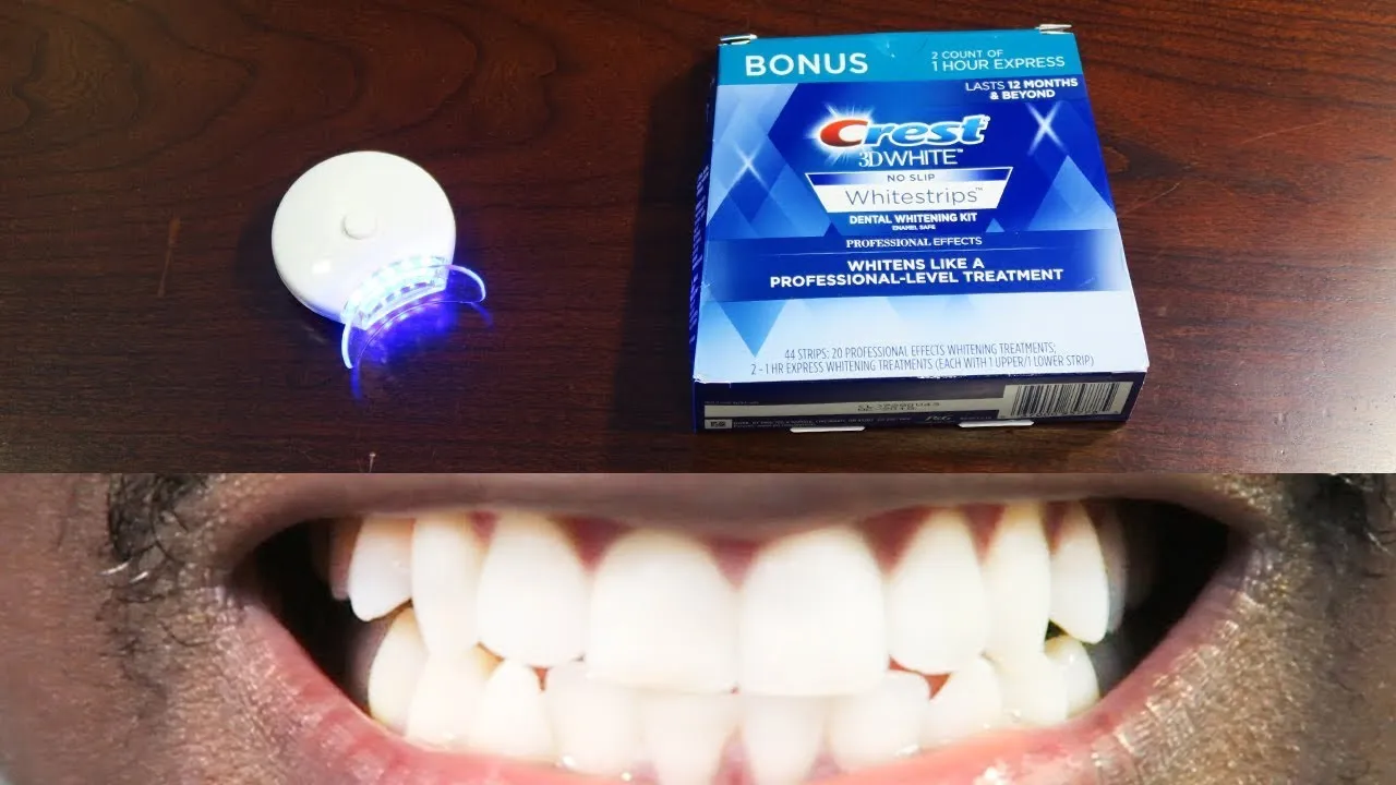 31471 teeth whitening kit