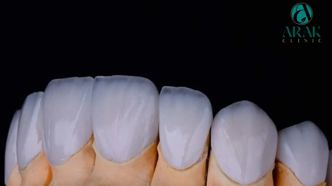 31479 zoom teeth whitening alternatives