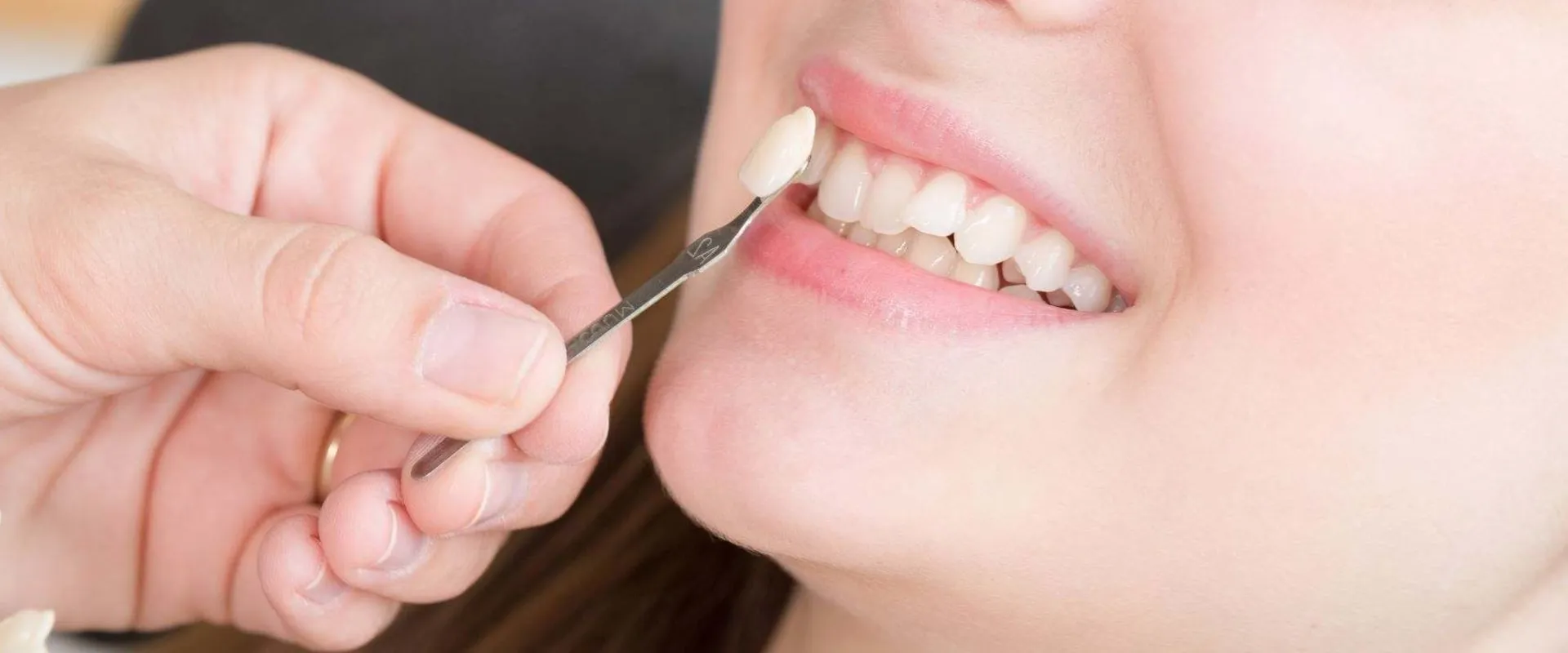 31481 whitening ingredients