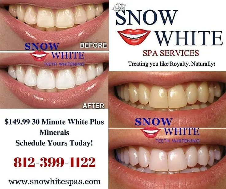 31492 teeth whitening toothpaste illinois