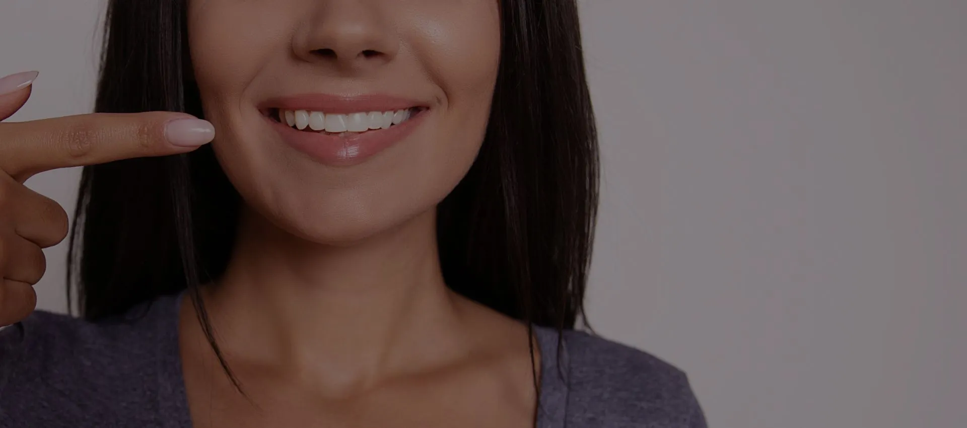 31503 teeth whitening spring hill fl 3