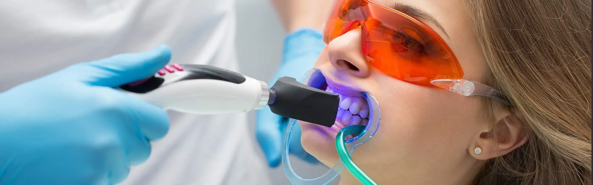 31526 professional teeth whitening