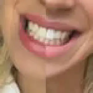 /img/31527-teeth-whitening-alternatives.webp