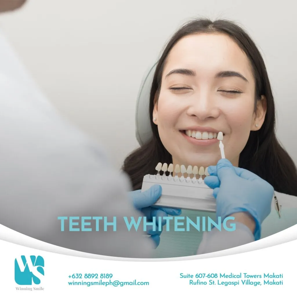 31533 teeth whitening philippines results