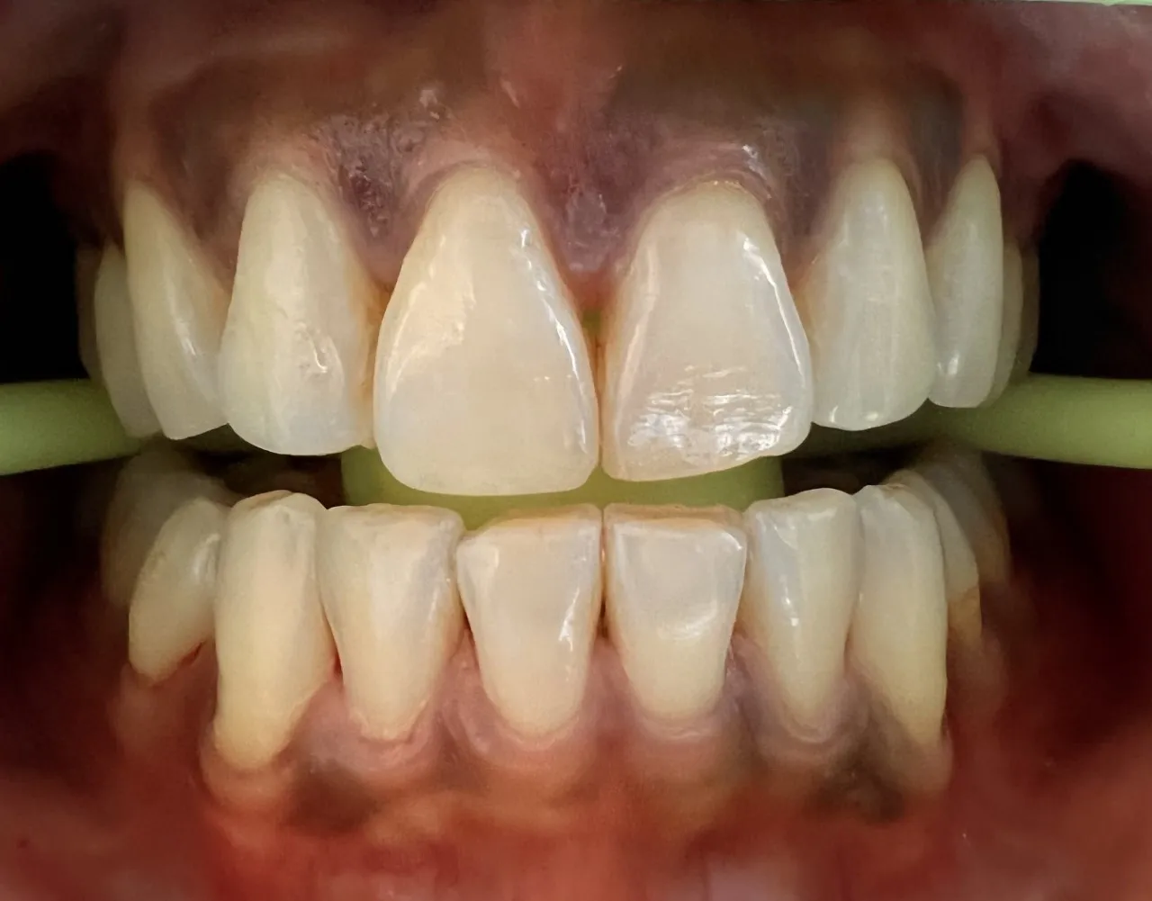 31542 oral hygiene rigby