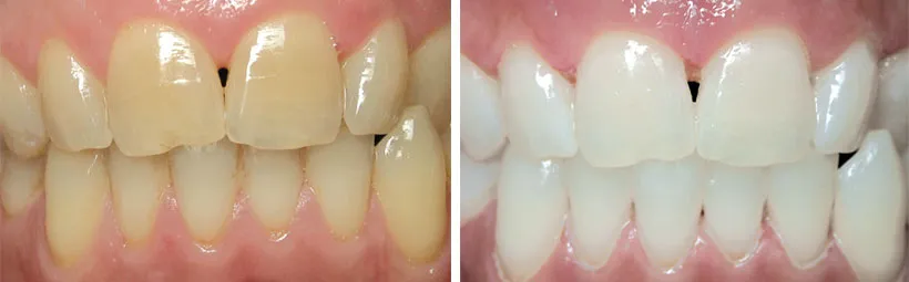 31556 dental hygiene