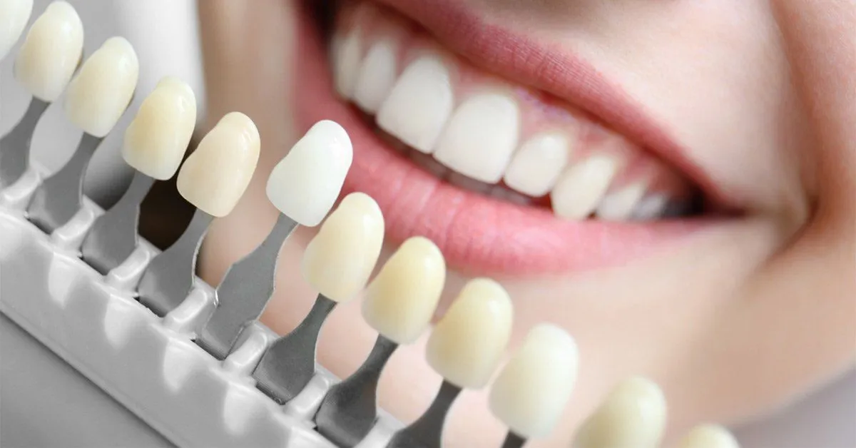 31557 teeth whitening products