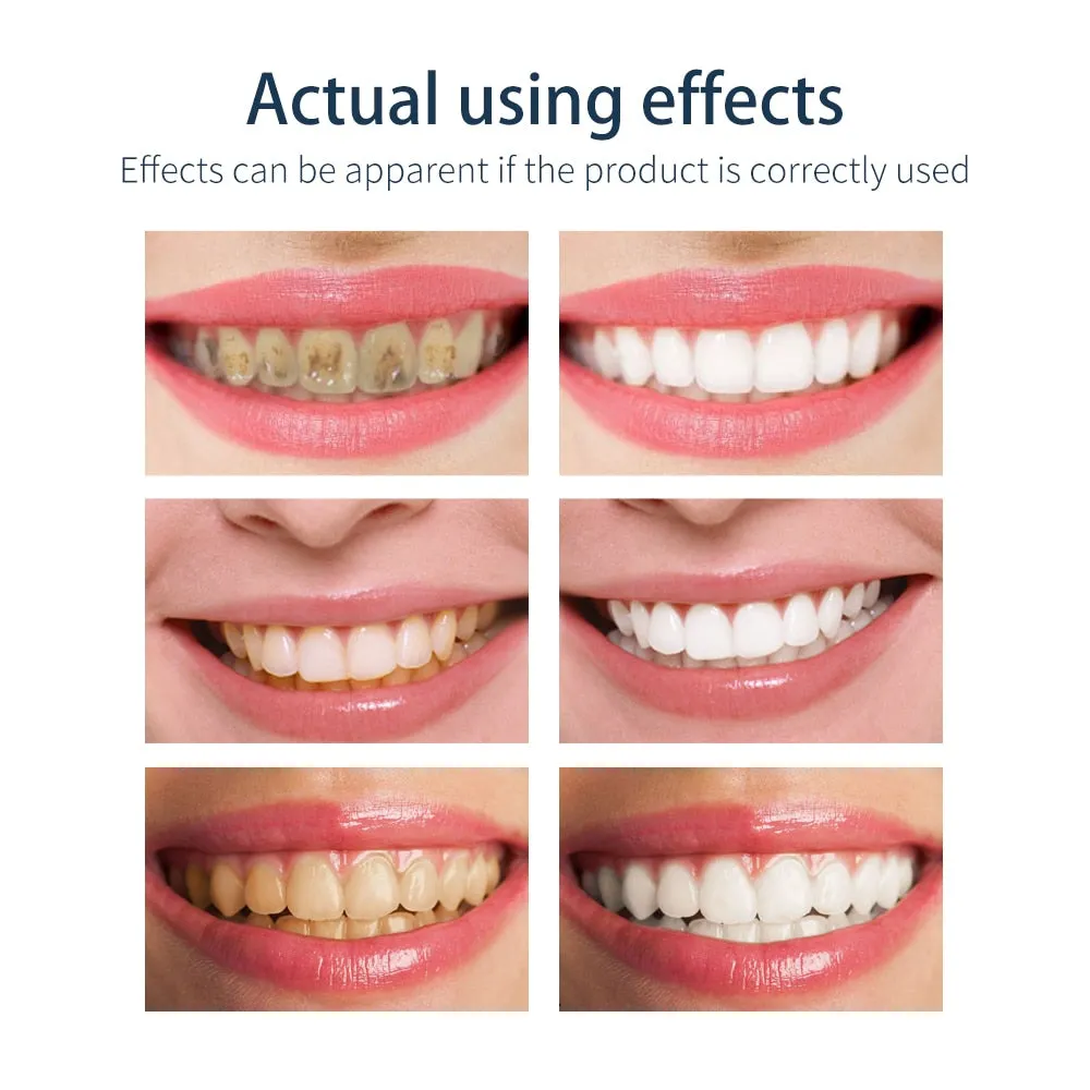 31561 boost confidence smile
