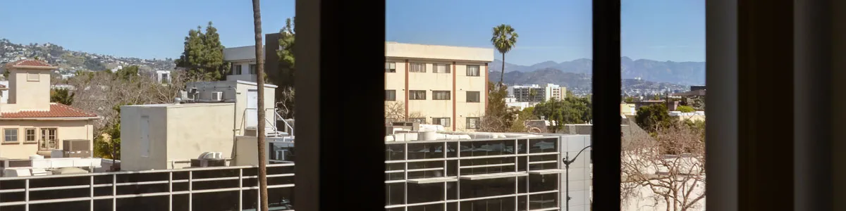 31567 teeth whitening consultation