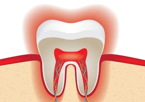 31578 fluoride treatment