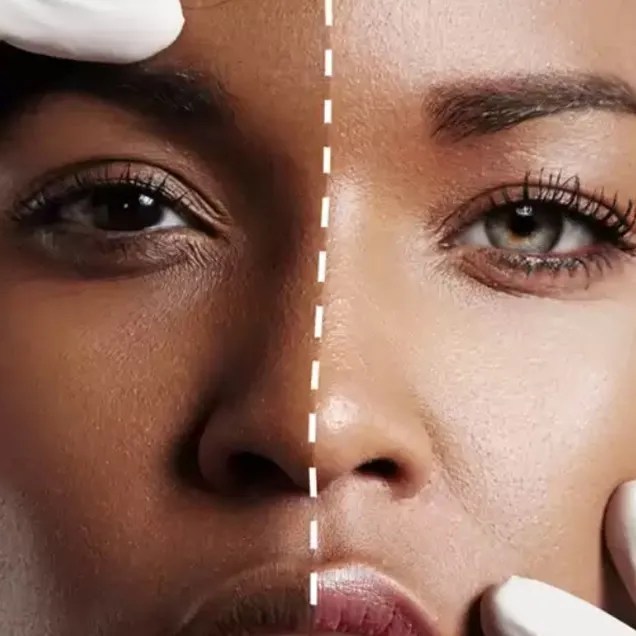 31580 chemical peels