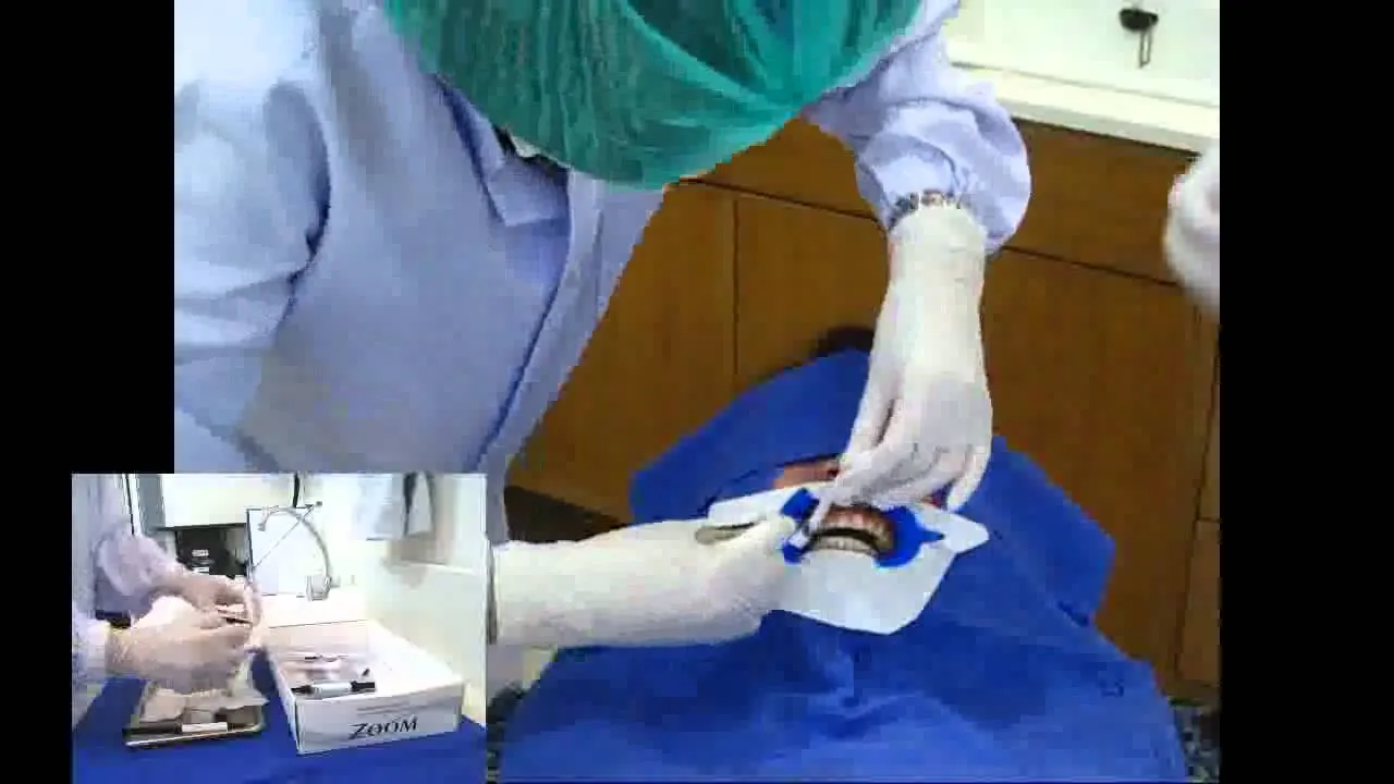 31586 zoom whitening youtube channels