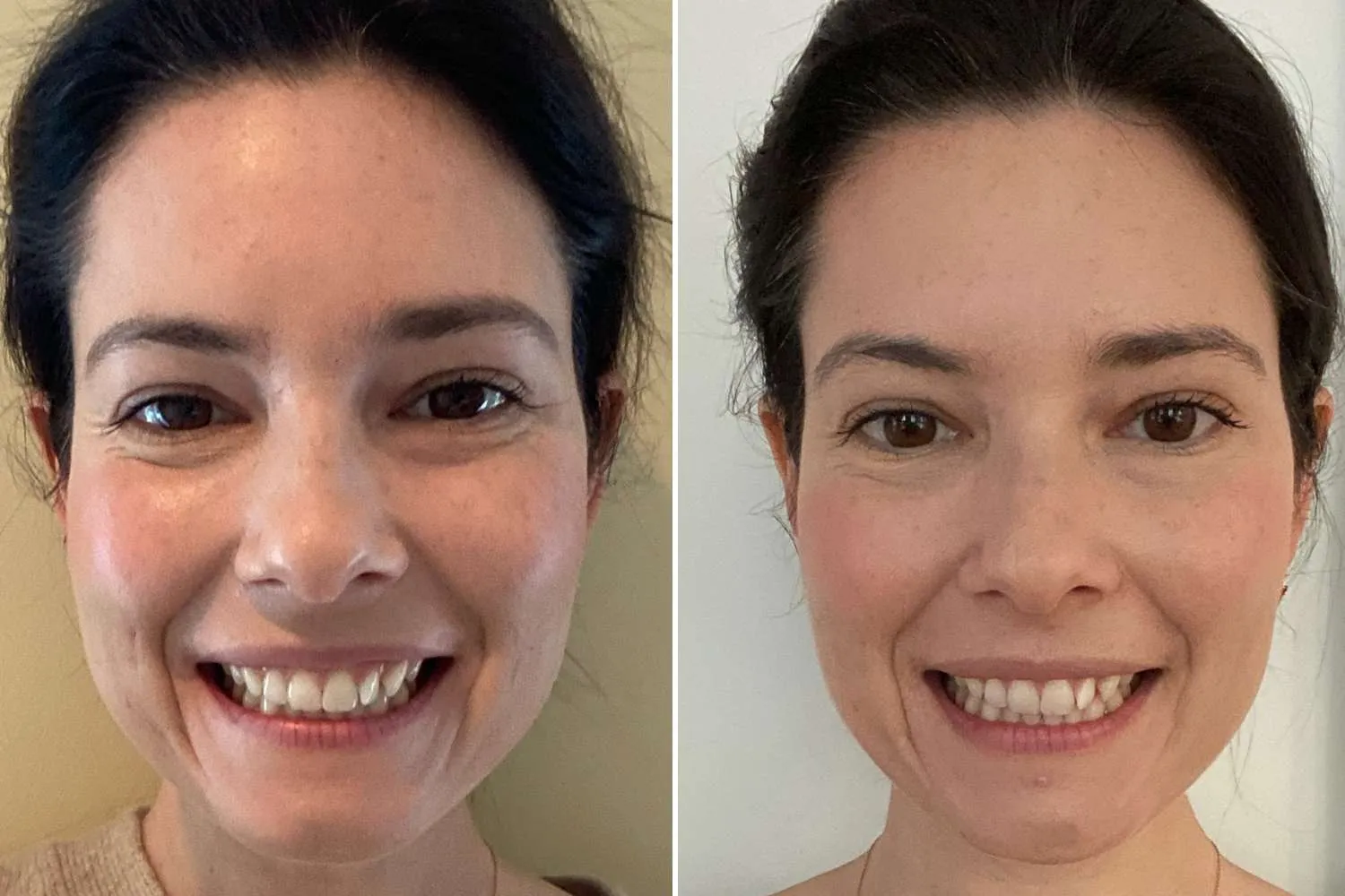 31589 snow teeth whitening serum