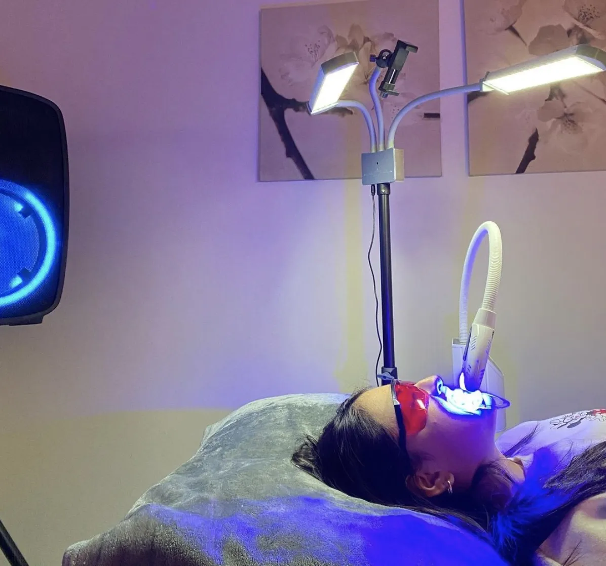 31595 teeth whitening oakville 5