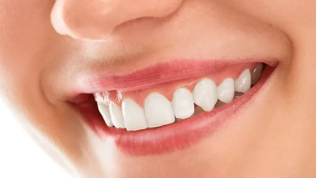 31595 teeth whitening oakville 7
