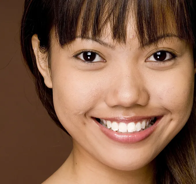 31605 teeth whitening maintenance