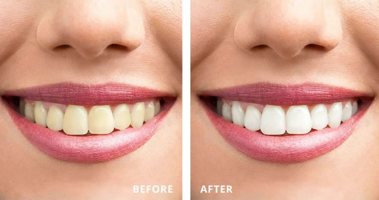 31605 whitening toothpaste ingredients