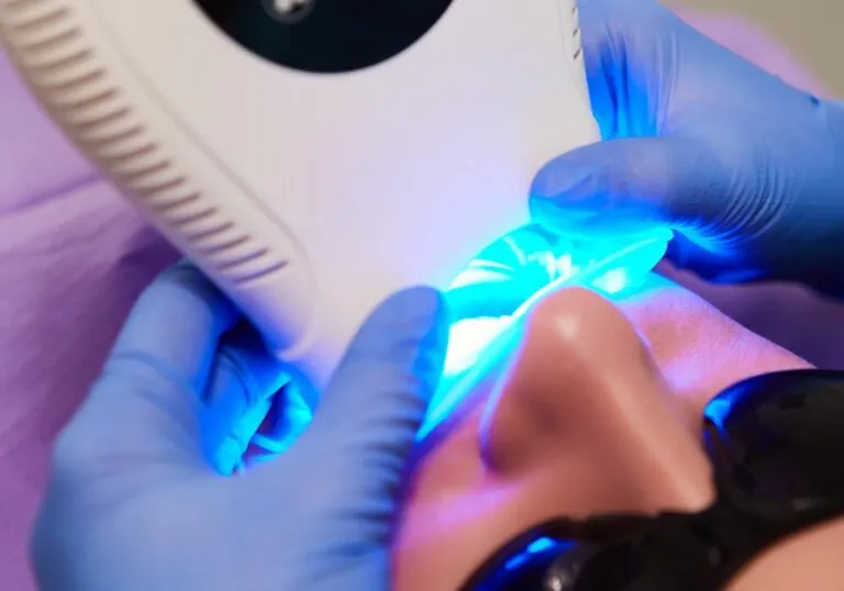 31607 teeth whitening process