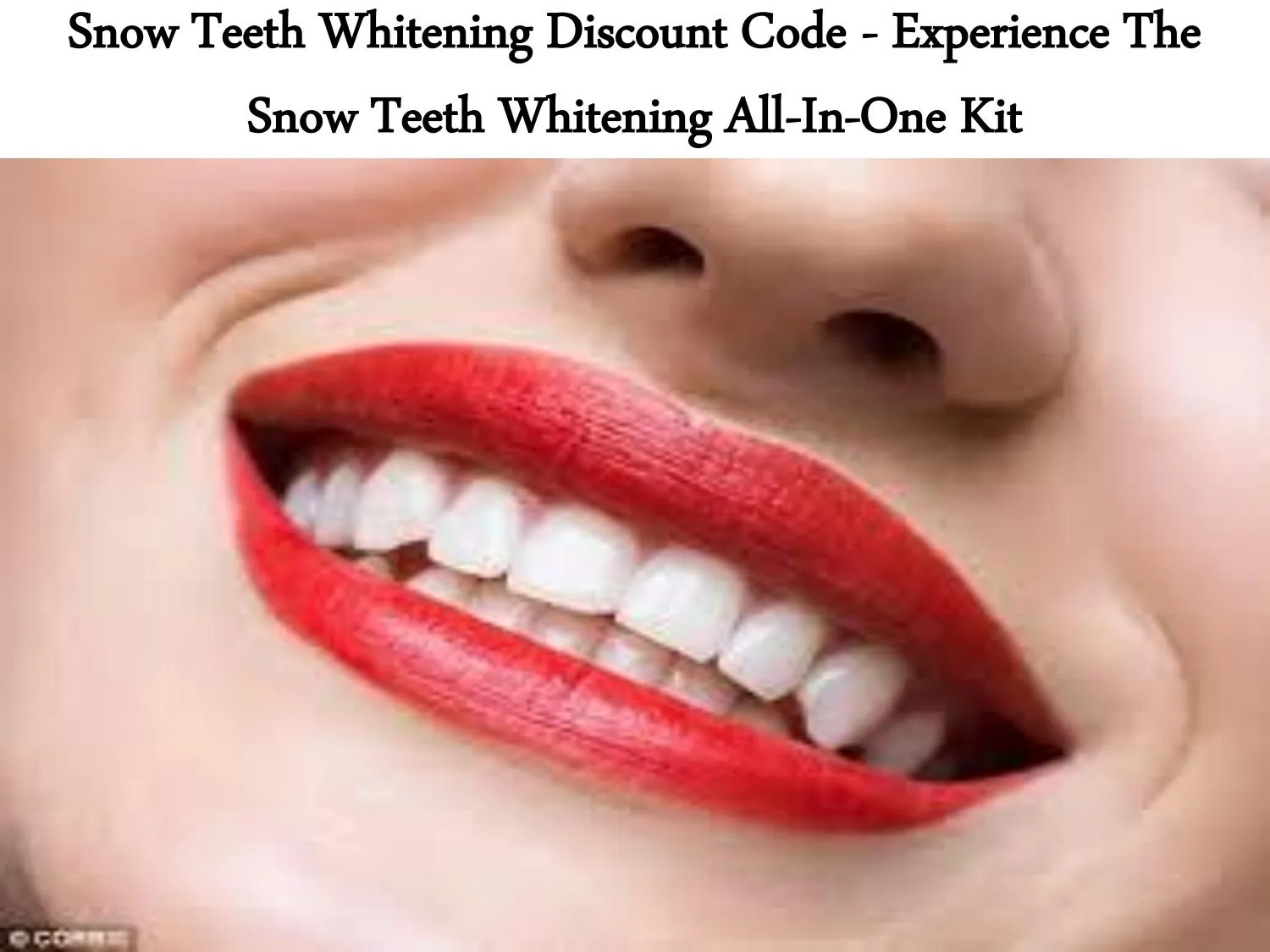 31625 snow teeth whitening before after