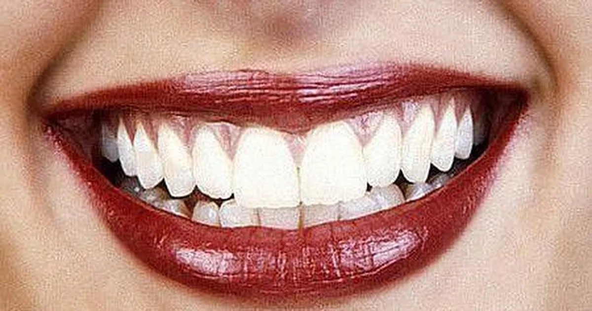 31627 oral hygiene tips