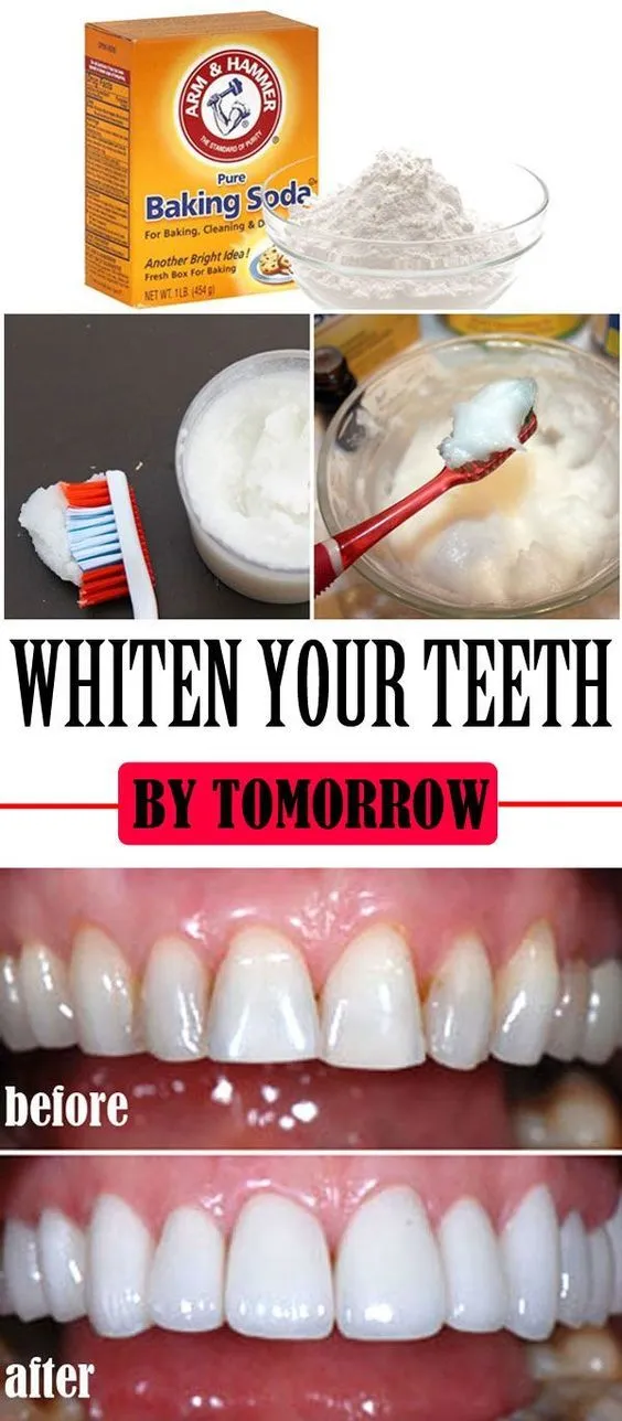31627 teeth whitening strip application