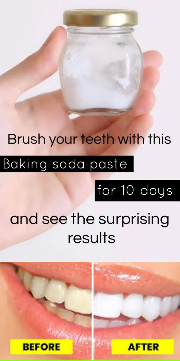 31627 teeth whitening strips