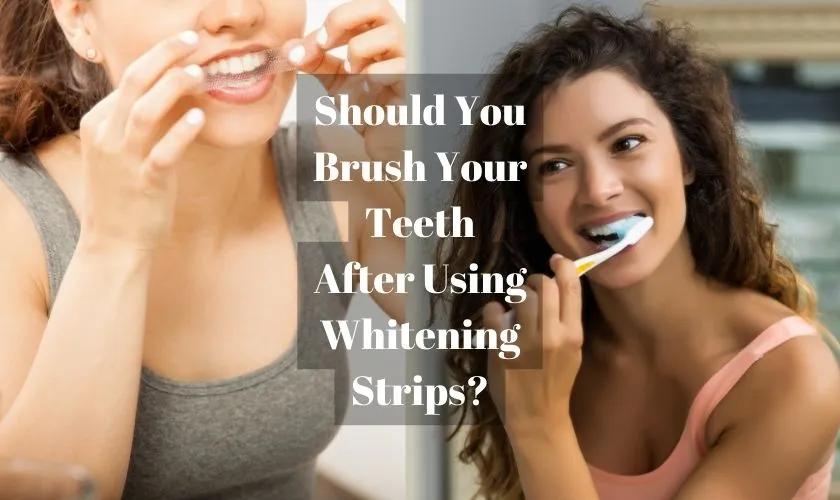 31628 whitening strips