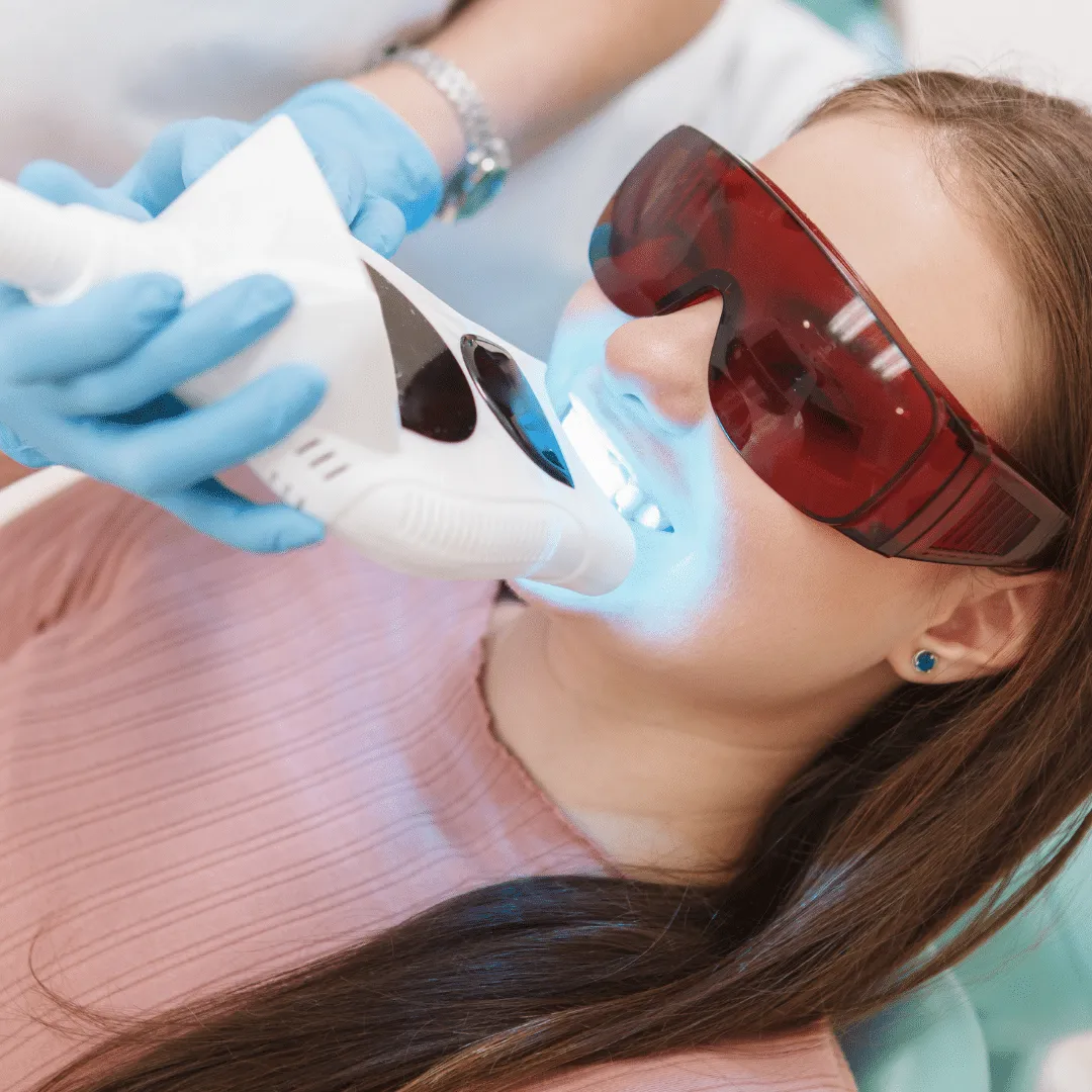 31629 zoom whitening procedure