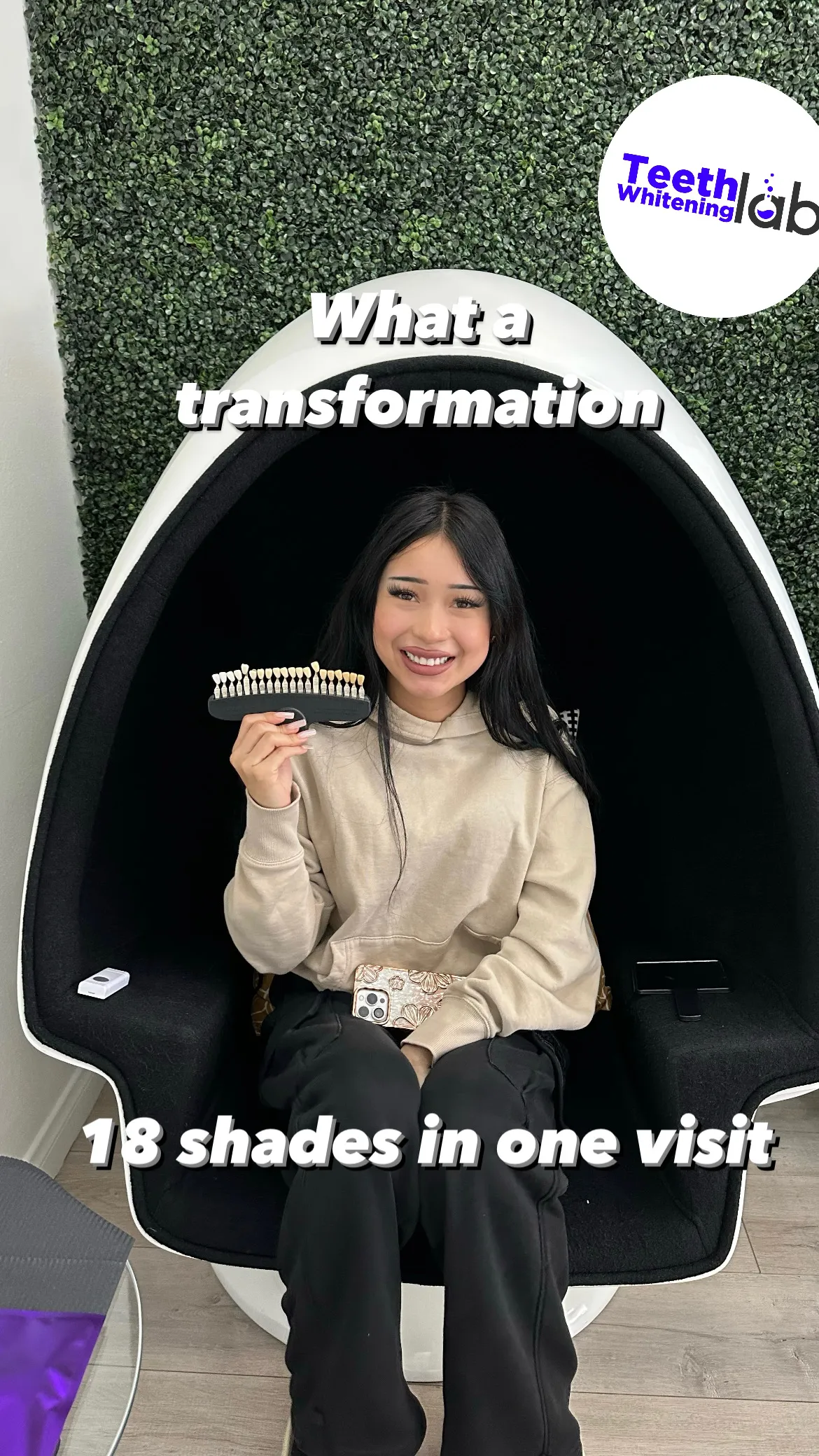 31632 teeth whitening results