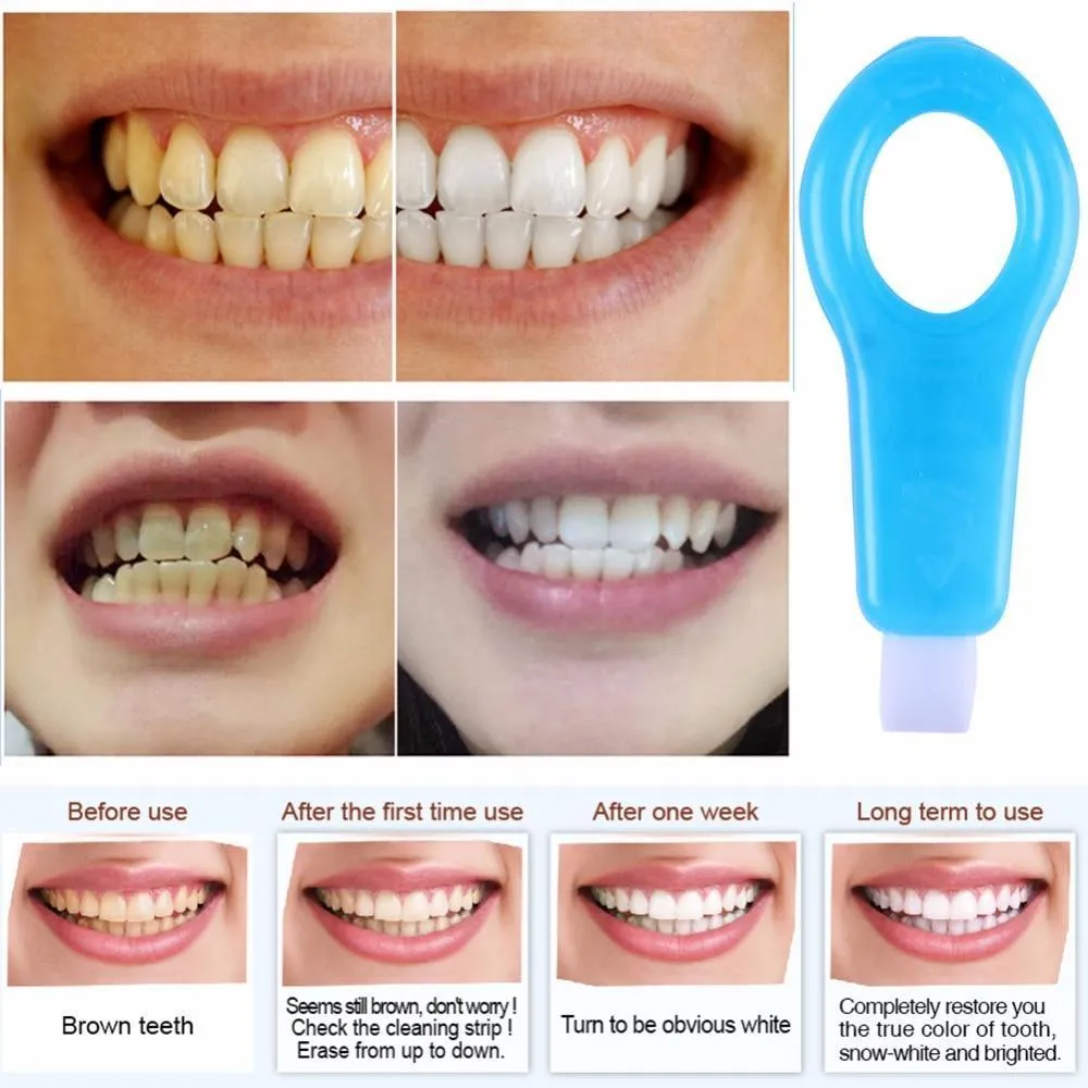 31639 teeth whitening results