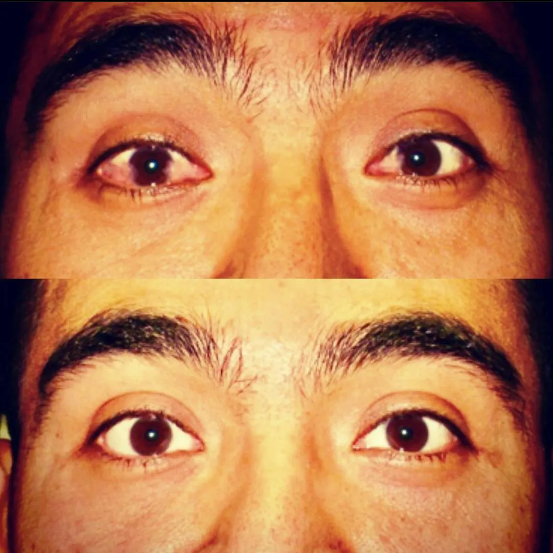 31640 eye whitening overview