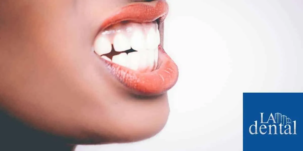 31641 zoom whitening side effects 2