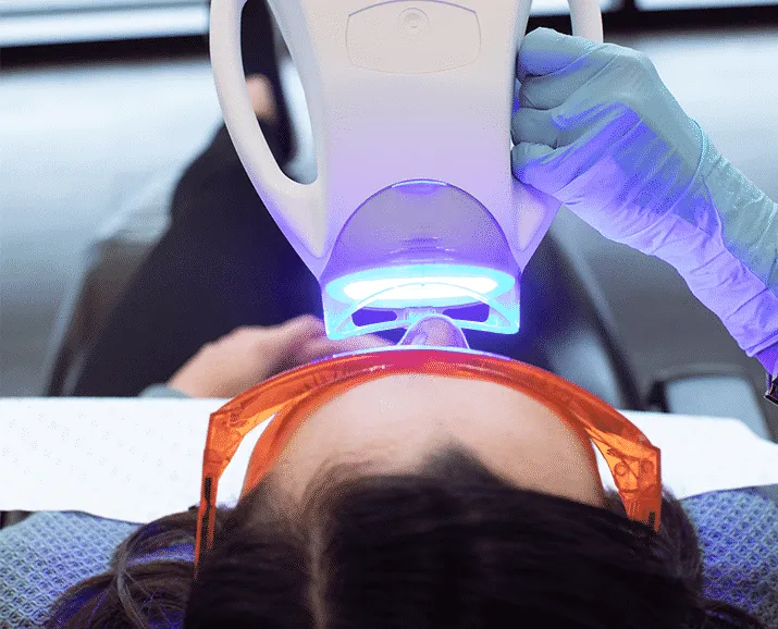 31641 zoom whitening side effects 6