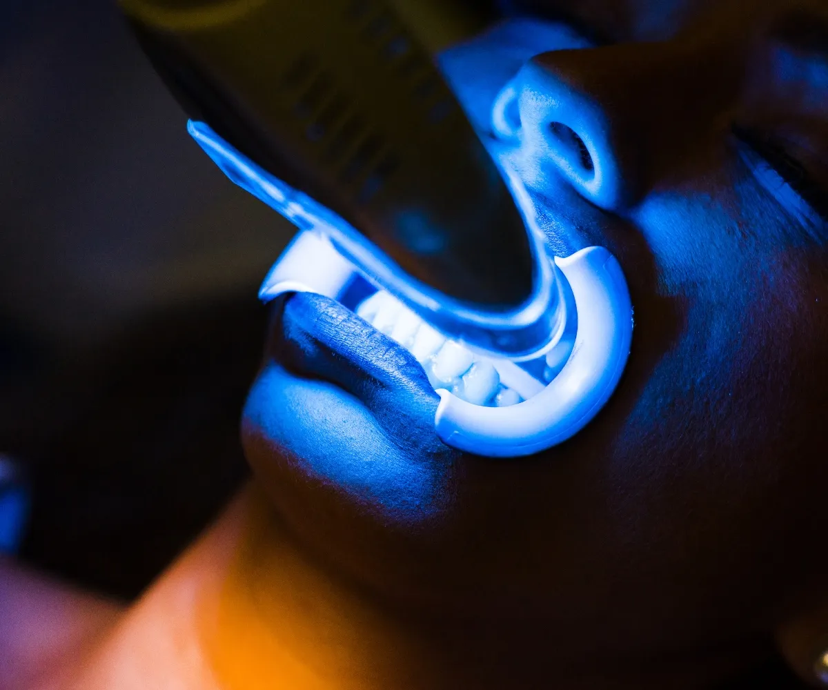 31644 chemical absorption