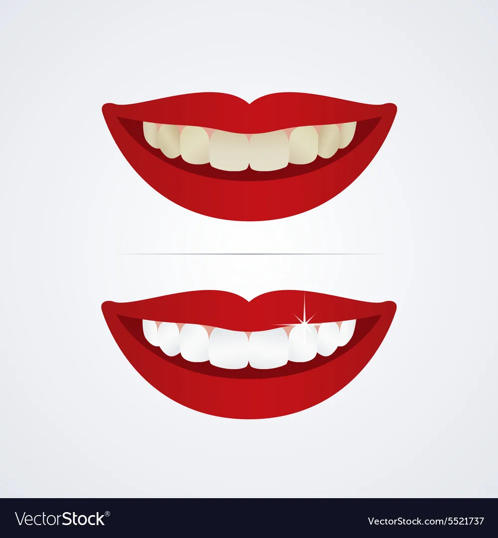 31648 teeth whitening stl sensitivity