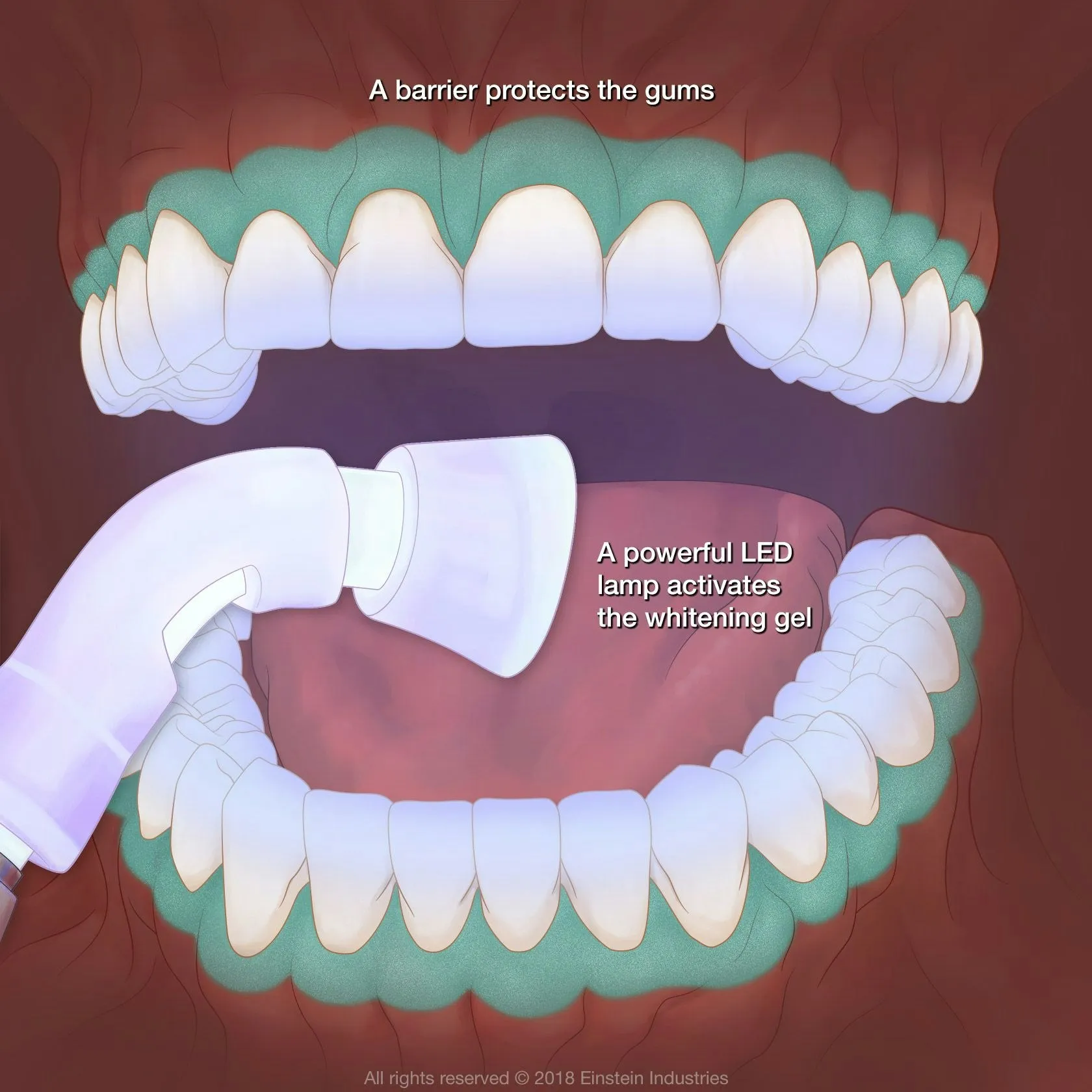 /img/31652-preventive-dental-care.webp