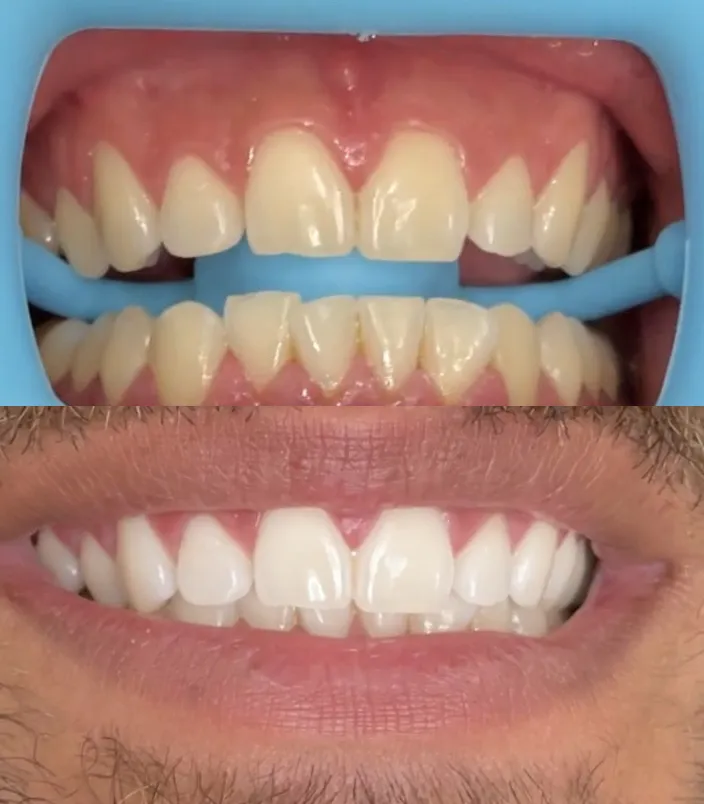 31653 san antonio dentist consultation