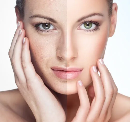 31658 face whitening