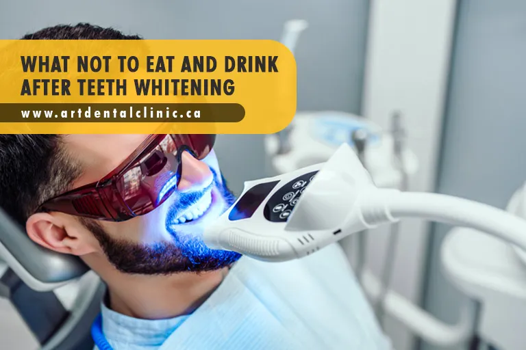 31666 teeth whitening aftercare image3