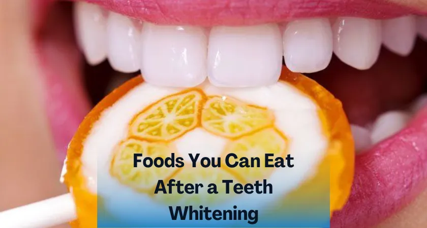 31666 teeth whitening aftercare image6