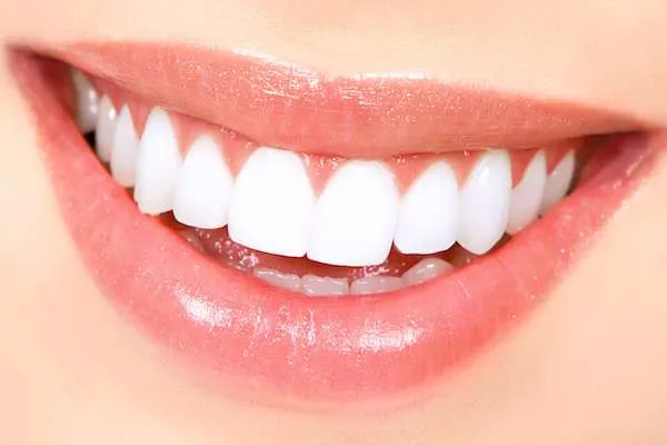31668 teeth whitening gainesville ga whitening kits