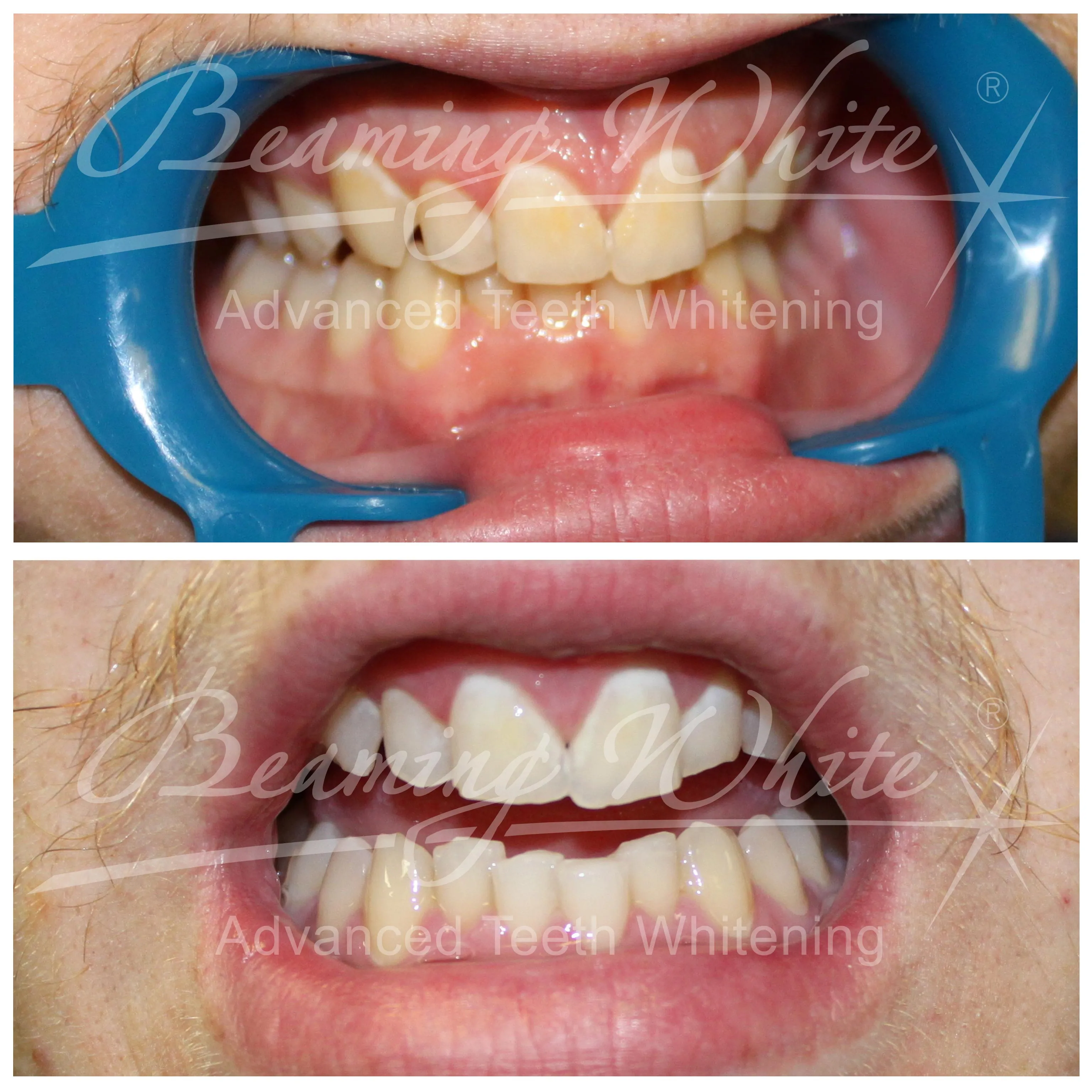 31671 healthy smile