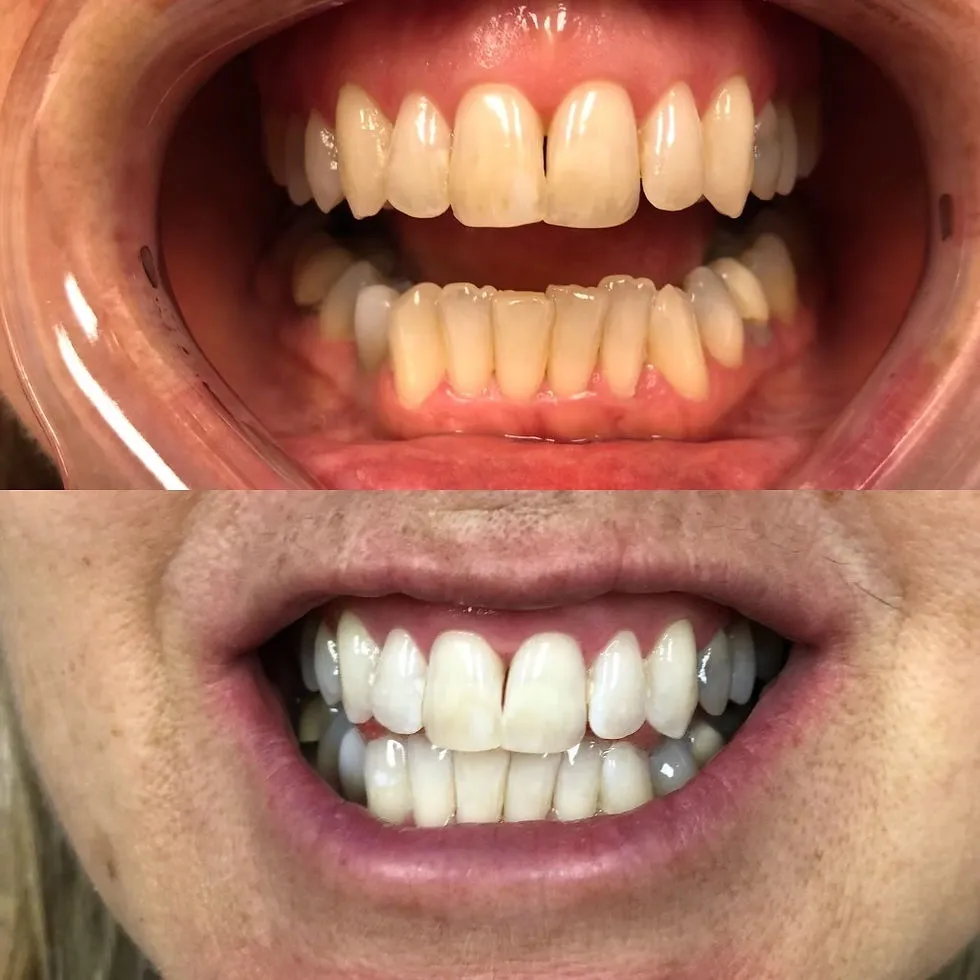 31676 brushing and flossing