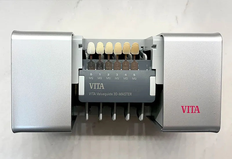 31700 teeth whitening before after