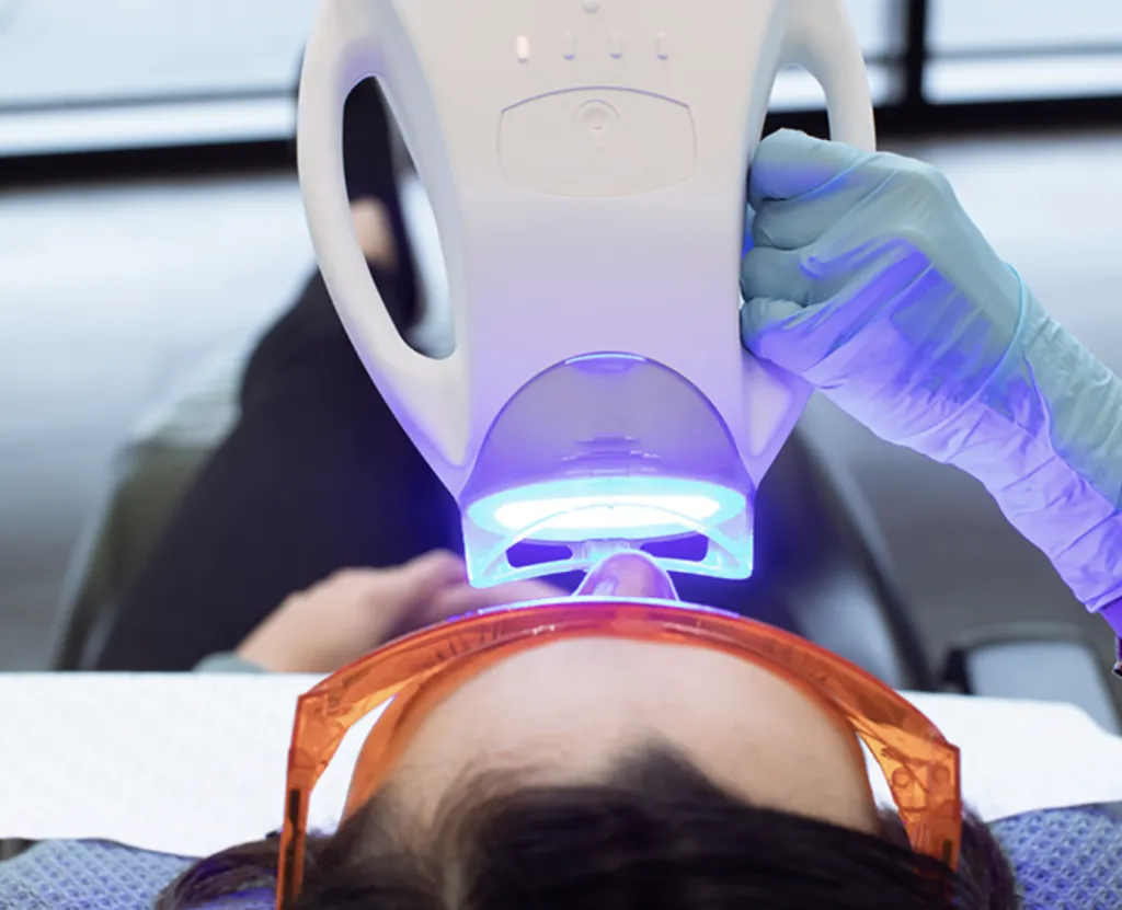 31702 invisalign teeth whitening