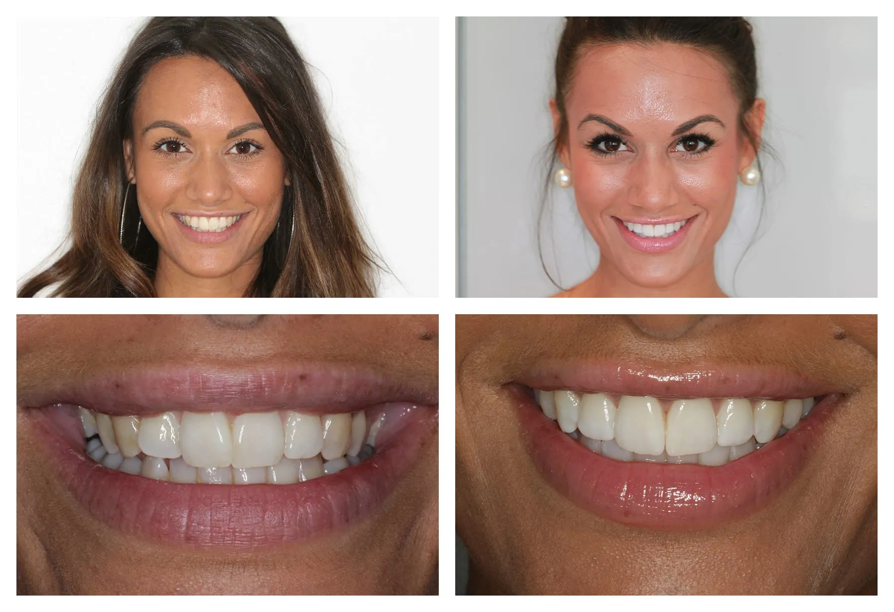 31702 teeth whitening products