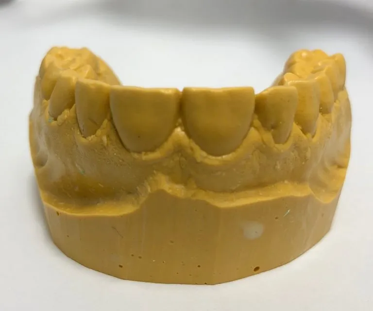 31703 maintaining results whitening trays