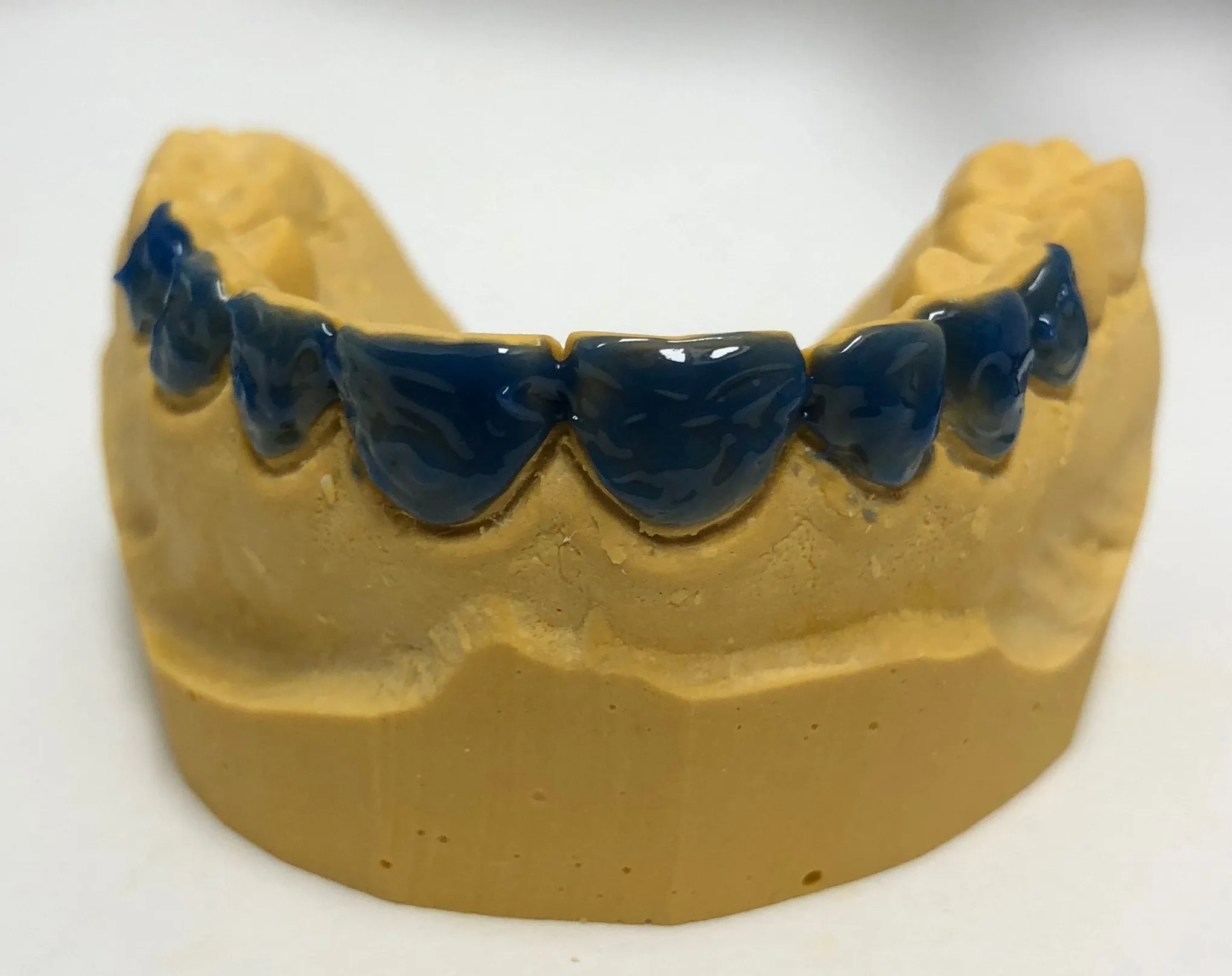 31703 whitening gel application