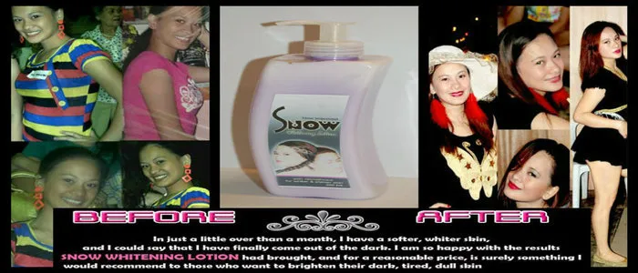 31705 snow whitening lotion sun damage